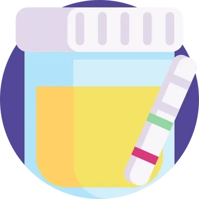 Urine sample cup with test strip